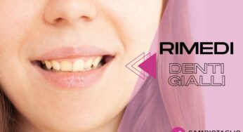 Denti gialli? Scopri dei semplici rimedi naturali che ti faranno tornare a sorridere senza vergognarti!